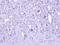Zinc Finger CCCH-Type Containing 8 antibody, LS-C185854, Lifespan Biosciences, Immunohistochemistry paraffin image 