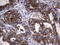 Metadherin antibody, LS-C339208, Lifespan Biosciences, Immunohistochemistry paraffin image 