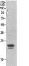 Sex Determining Region Y antibody, A00614, Boster Biological Technology, Western Blot image 