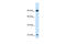 SRY-Box 30 antibody, 27-523, ProSci, Enzyme Linked Immunosorbent Assay image 