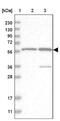 Zinc Finger Protein 250 antibody, NBP1-81052, Novus Biologicals, Western Blot image 