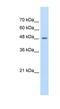 Family With Sequence Similarity 174 Member B antibody, NBP1-91565, Novus Biologicals, Western Blot image 