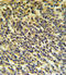 85 kDa calcium-independent phospholipase A2 antibody, LS-C163764, Lifespan Biosciences, Immunohistochemistry paraffin image 