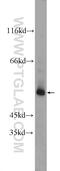 POTE Ankyrin Domain Family Member A antibody, 24593-1-AP, Proteintech Group, Western Blot image 
