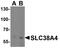 Solute Carrier Family 38 Member 4 antibody, A07283, Boster Biological Technology, Western Blot image 