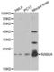 RAB5A, Member RAS Oncogene Family antibody, abx001094, Abbexa, Western Blot image 