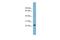 NKG2-E type II integral membrane protein antibody, A10152, Boster Biological Technology, Western Blot image 