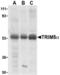 Tripartite Motif Containing 5 antibody, TA306152, Origene, Western Blot image 