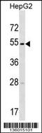 Transmembrane Serine Protease 11E antibody, 58-543, ProSci, Western Blot image 