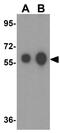 Aldehyde Dehydrogenase 5 Family Member A1 antibody, GTX17016, GeneTex, Western Blot image 