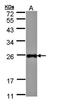 Lipopolysaccharide Induced TNF Factor antibody, orb73625, Biorbyt, Western Blot image 