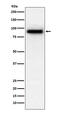 Phosphodiesterase 4D antibody, M01111, Boster Biological Technology, Western Blot image 