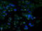 Retinol dehydrogenase 11 antibody, M06946, Boster Biological Technology, Immunofluorescence image 