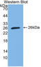 Interleukin 34 antibody, LS-C314266, Lifespan Biosciences, Western Blot image 