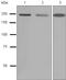 Myosin Heavy Chain 11 antibody, ab133567, Abcam, Western Blot image 