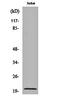 Coatomer Protein Complex Subunit Zeta 1 antibody, orb160542, Biorbyt, Western Blot image 