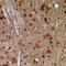 Quiescin Sulfhydryl Oxidase 1 antibody, LS-C668055, Lifespan Biosciences, Immunohistochemistry paraffin image 