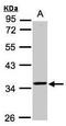 TRNA Methyltransferase 10B antibody, PA5-28521, Invitrogen Antibodies, Western Blot image 