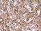 Apoptotic Peptidase Activating Factor 1 antibody, LS-C405390, Lifespan Biosciences, Immunohistochemistry paraffin image 