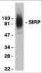 Signal Regulatory Protein Alpha antibody, 1125, ProSci, Western Blot image 