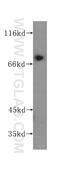 Procollagen-Lysine,2-Oxoglutarate 5-Dioxygenase 3 antibody, 60058-1-Ig, Proteintech Group, Western Blot image 