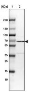 Nuclear Receptor Subfamily 1 Group D Member 2 antibody, NBP2-47306, Novus Biologicals, Western Blot image 