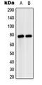 Mannan Binding Lectin Serine Peptidase 2 antibody, GTX16976, GeneTex, Western Blot image 