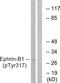 EPH Receptor B1 antibody, PA5-38482, Invitrogen Antibodies, Western Blot image 