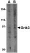 Glutamate Ionotropic Receptor Kainate Type Subunit 3 antibody, MBS151389, MyBioSource, Western Blot image 