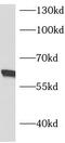 Asparagine Synthetase (Glutamine-Hydrolyzing) antibody, FNab00644, FineTest, Western Blot image 