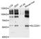 Solute Carrier Family 22 Member 1 antibody, LS-B15175, Lifespan Biosciences, Western Blot image 