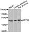 Keratin 13 antibody, A7697, ABclonal Technology, Western Blot image 