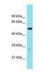 Glucagon Like Peptide 1 Receptor antibody, orb331278, Biorbyt, Western Blot image 