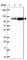 SPT20 Homolog, SAGA Complex Component antibody, HPA038907, Atlas Antibodies, Western Blot image 