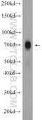 C-X-C Motif Chemokine Receptor 4 antibody, 11073-2-AP, Proteintech Group, Western Blot image 