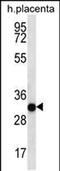 COP9 Signalosome Subunit 7A antibody, PA5-48458, Invitrogen Antibodies, Western Blot image 