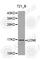 Lipocalin 6 antibody, A1204, ABclonal Technology, Western Blot image 