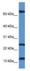 Tubulointerstitial Nephritis Antigen Like 1 antibody, NBP1-74080, Novus Biologicals, Western Blot image 