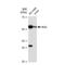 Mixed Lineage Kinase Domain Like Pseudokinase antibody, GTX00953, GeneTex, Western Blot image 