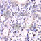Histone Acetyltransferase 1 antibody, A6188, ABclonal Technology, Immunohistochemistry paraffin image 