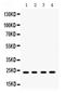 RAB9A, Member RAS Oncogene Family antibody, PB9884, Boster Biological Technology, Western Blot image 