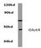 Solute carrier family 2, facilitated glucose transporter member 4 antibody, AP20773PU-N, Origene, Western Blot image 