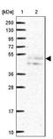 Cytokine Receptor Like Factor 1 antibody, NBP1-85605, Novus Biologicals, Western Blot image 