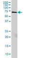 Myristoylated Alanine Rich Protein Kinase C Substrate antibody, H00004082-M06, Novus Biologicals, Western Blot image 