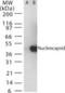 SARS CoV Nucleoprotein antibody, NB100-56576, Novus Biologicals, Western Blot image 