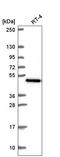 Hydroxyacyl-CoA Dehydrogenase Trifunctional Multienzyme Complex Subunit Beta antibody, HPA066099, Atlas Antibodies, Western Blot image 