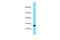 Transcription Factor 21 antibody, 27-860, ProSci, Western Blot image 