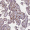 CD33 Molecule antibody, HPA035832, Atlas Antibodies, Immunohistochemistry paraffin image 