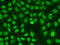 Checkpoint Kinase 2 antibody, 13-179, ProSci, Immunofluorescence image 