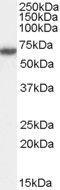 FA Complementation Group G antibody, GTX89053, GeneTex, Western Blot image 